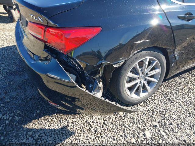 Acura TLX Tech Pkg Image 2